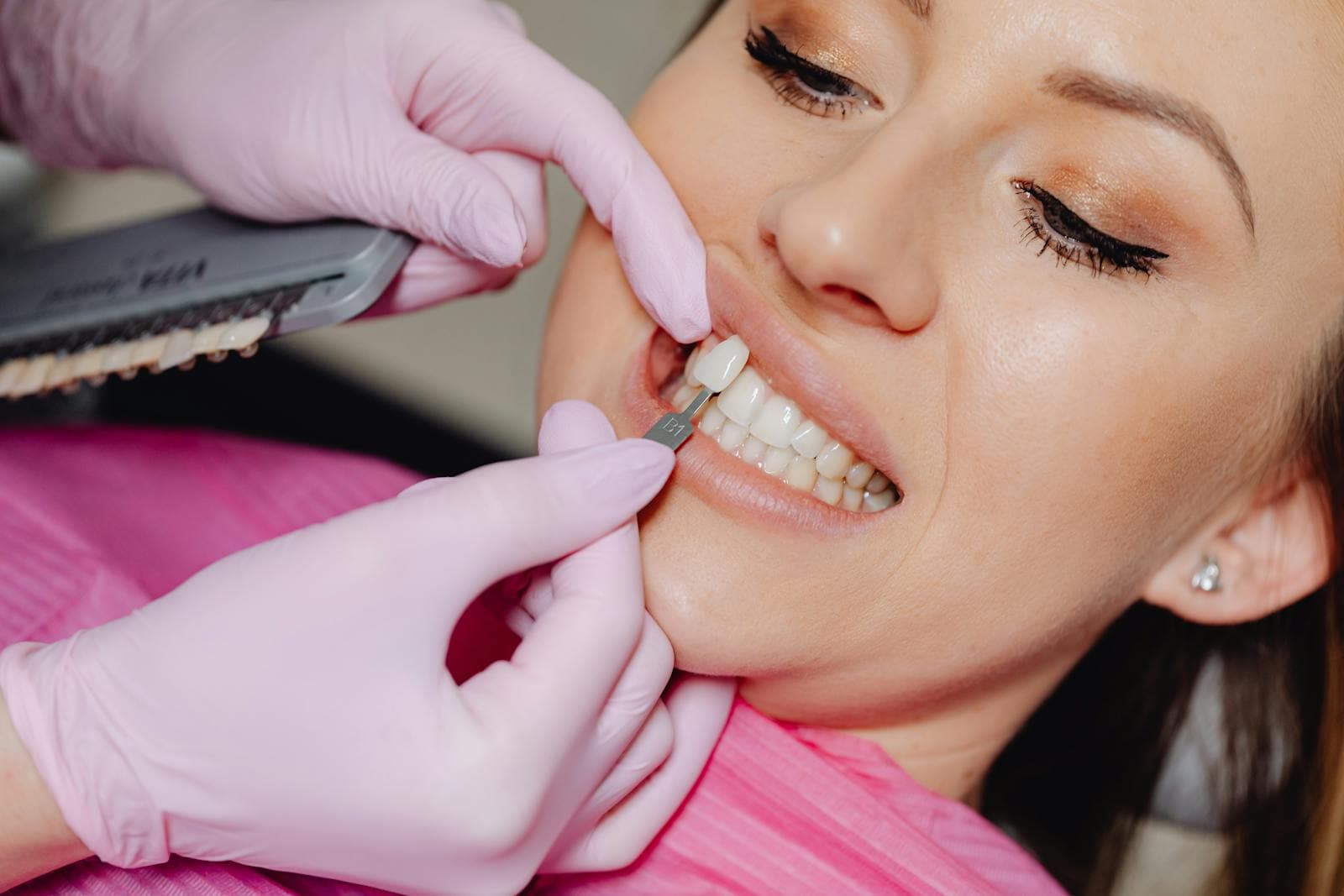 Close-up of a porcelain veneer being applied during treatment